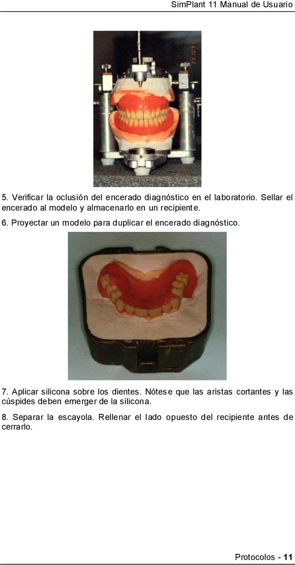 Proyectar un modelo para duplicar el encerado diagnóstico. 7. Aplicar silicona sobre los dientes.