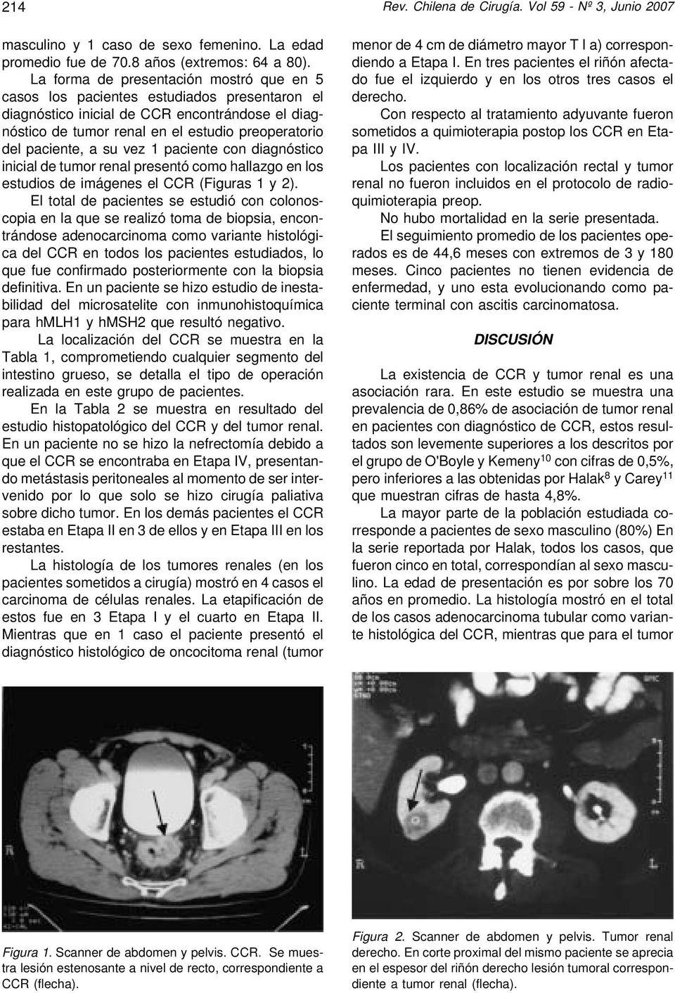 a su vez 1 paciente con diagnóstico inicial de tumor renal presentó como hallazgo en los estudios de imágenes el CCR (Figuras 1 y 2).