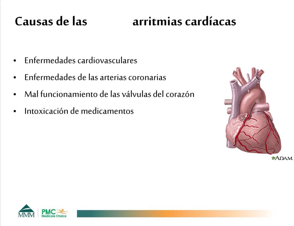 de las arterias coronarias Mal