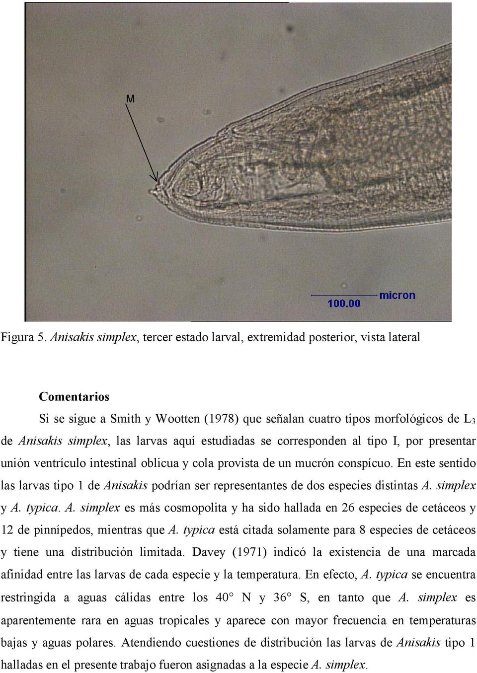 larvas aquí estudiadas se corresponden al tipo I, por presentar unión ventrículo intestinal oblicua y cola provista de un mucrón conspícuo.