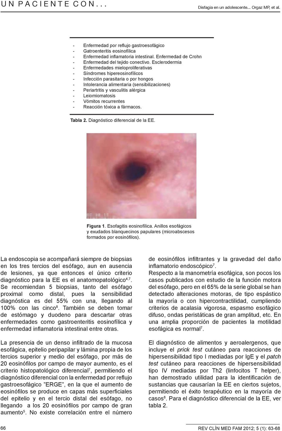 alérgica - Leiomiomatosis - Vómitos recurrentes - Reacción tóxica a fármacos. Tabla 2. Diagnóstico diferencial de la EE. Figura 1. Esofagitis eosinofílica.