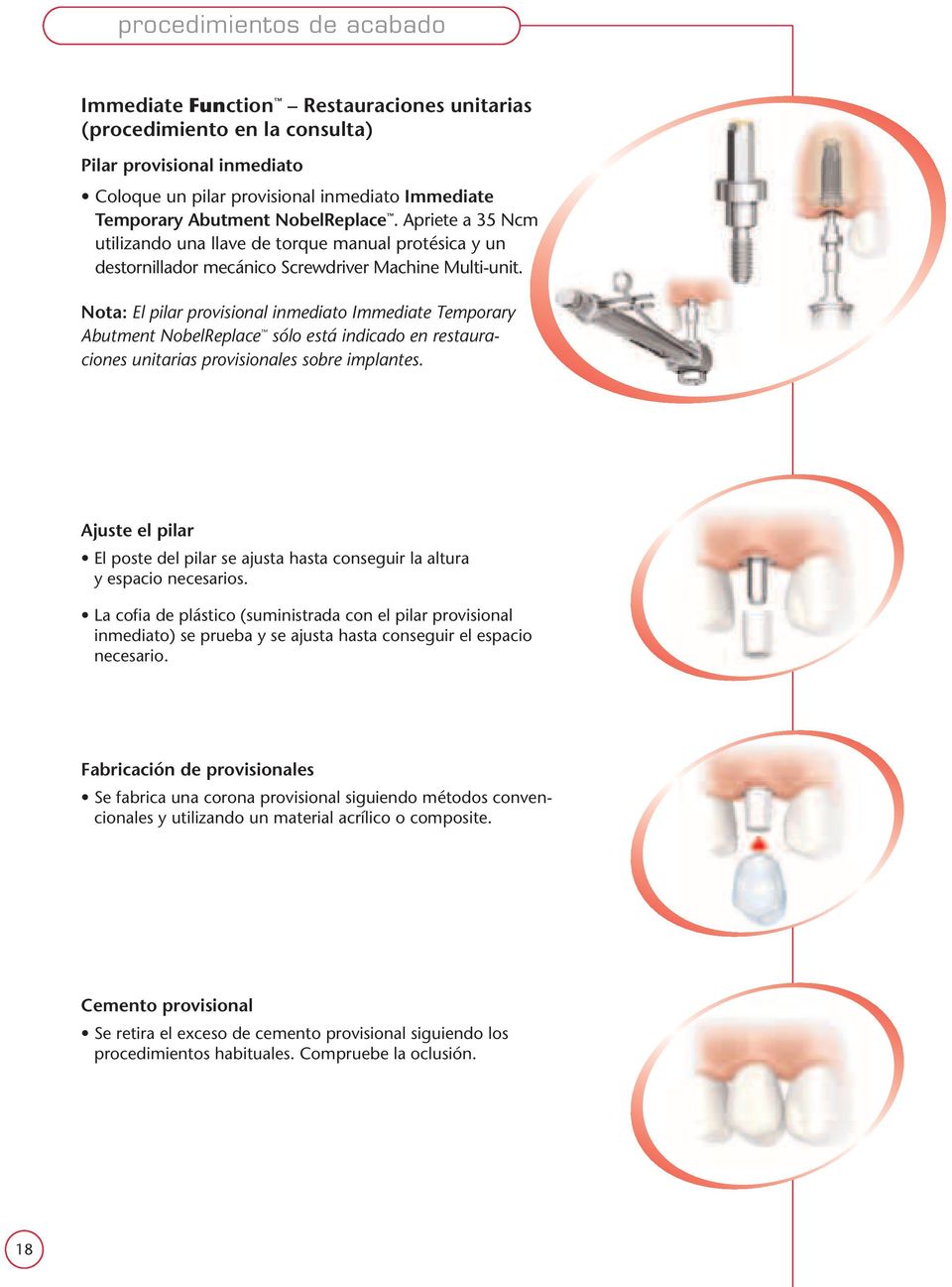 Nota: El pilar provisional inmediato Immediate Temporary Abutment NobelReplace sólo está indicado en restauraciones unitarias provisionales sobre implantes.