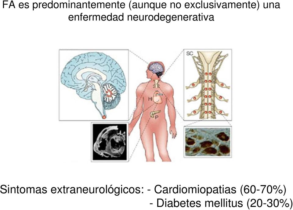 neurodegenerativa Sintomas