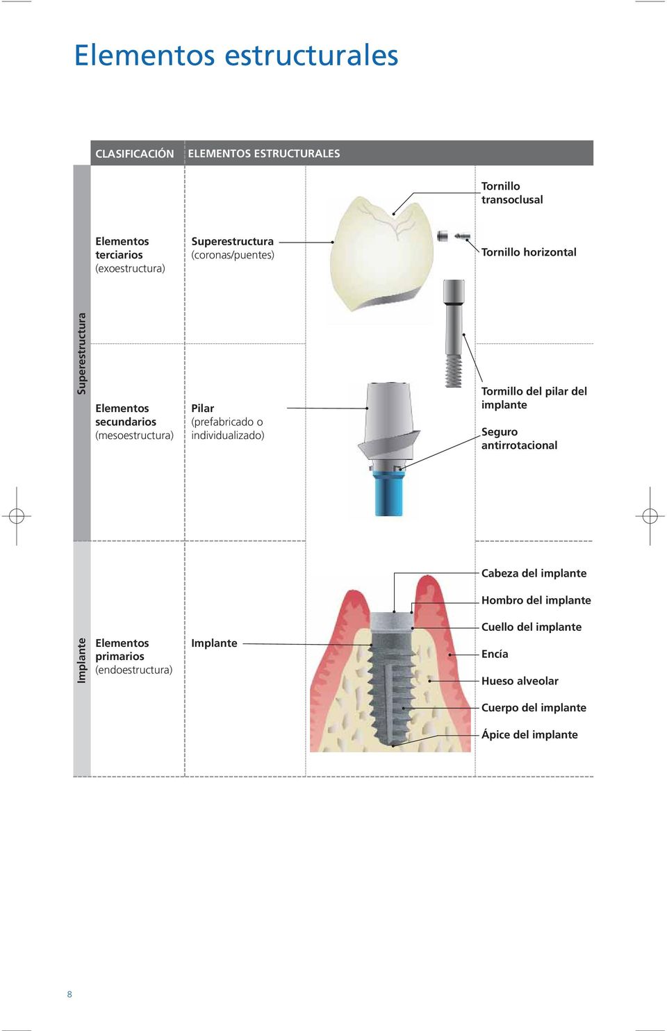 (prefabricado o individualizado) Tormillo del pilar del implante Seguro antirrotacional Cabeza del implante Hombro del