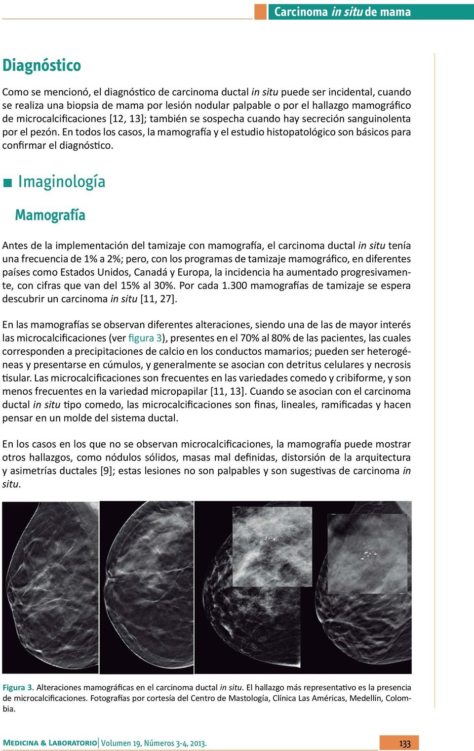 En todos los casos, la mamografía y el estudio histopatológico son básicos para confirmar el diagnóstico.