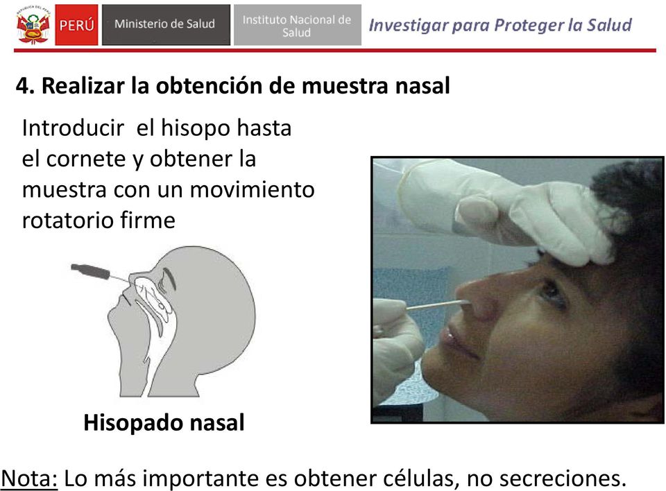 un movimiento rotatorio firme Hisopado nasal Nota: