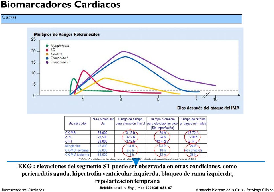 2004 EKG : elevaciones del segmento ST puede ser observada en otras condiciones, como