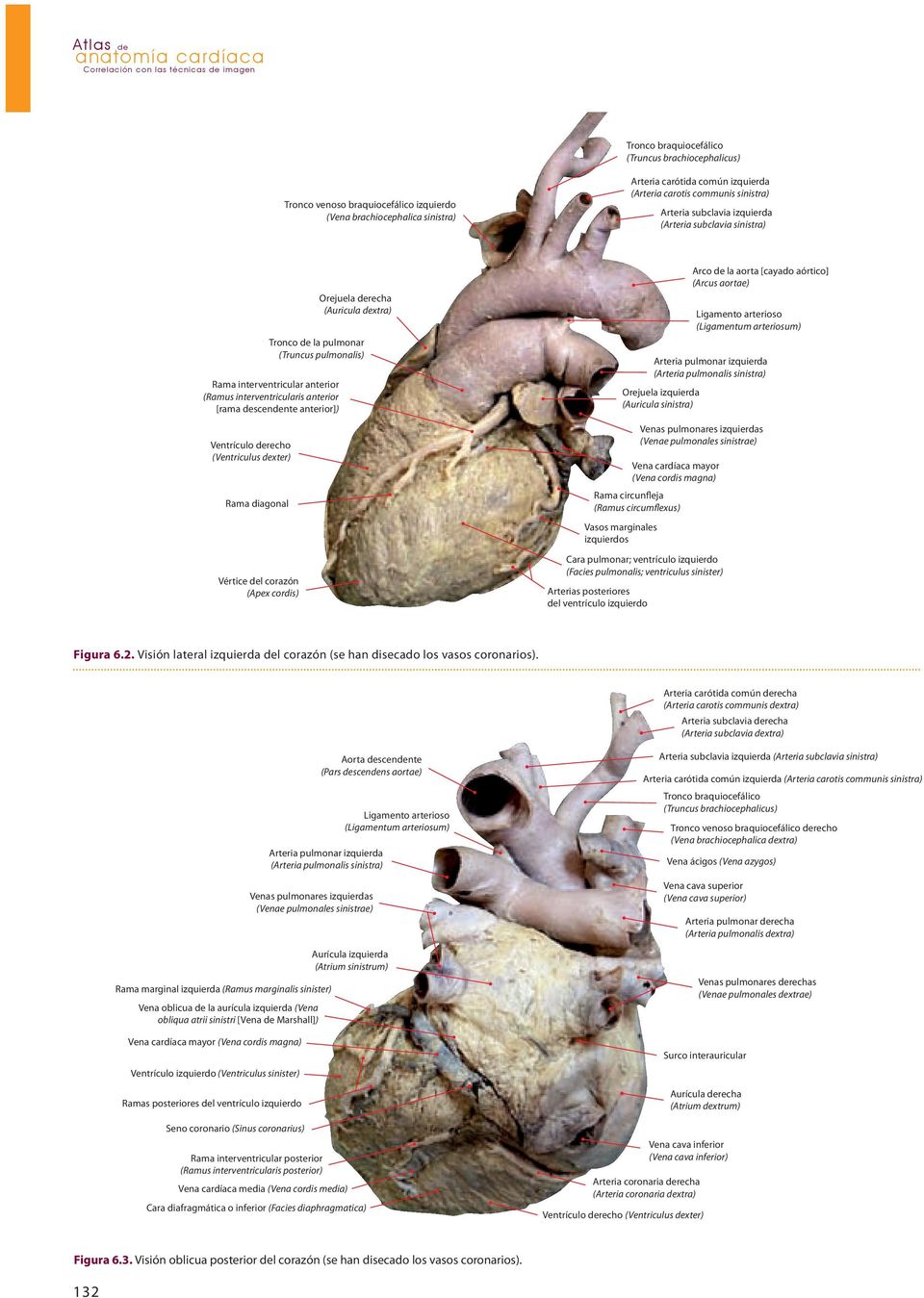 Rama interventricular anterior (Ramus interventricularis anterior [rama descendente anterior]) Ventrículo derecho (Ventriculus dexter) Rama diagonal Vértice del corazón (Apex cordis) Arterias