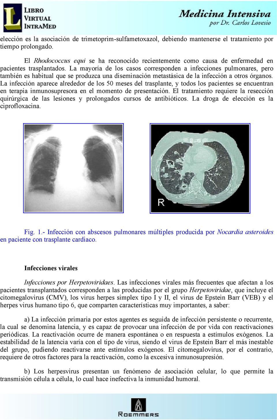 La mayoría de los casos corresponden a infecciones pulmonares, pero también es habitual que se produzca una diseminación metastásica de la infección a otros órganos.
