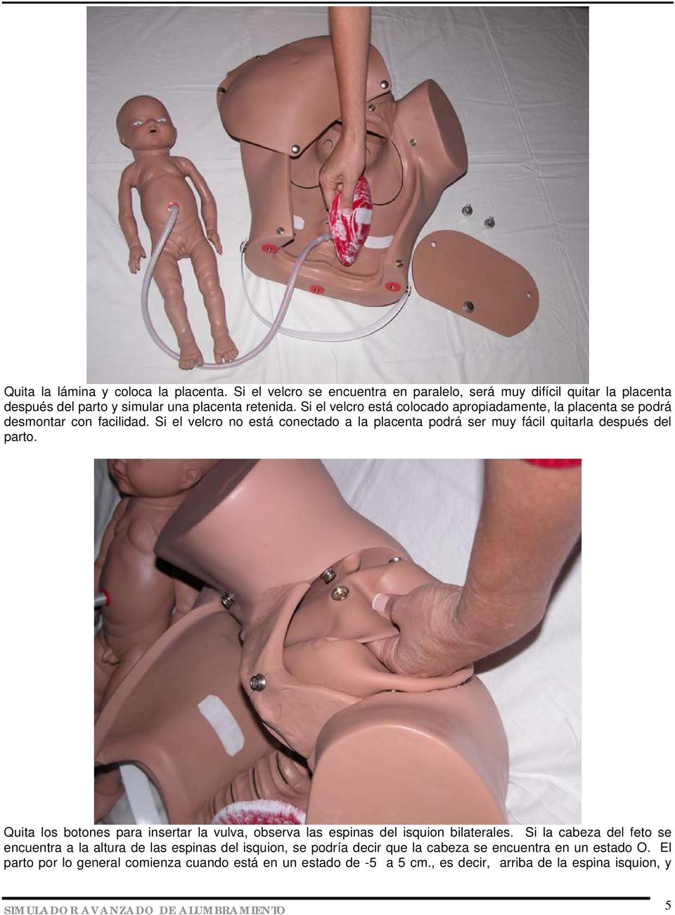 Si el velcro no está conectado a la placenta podrá ser muy fácil quitarla después del parto. Quita los botones para insertar la vulva, observa las espinas del isquion bilaterales.