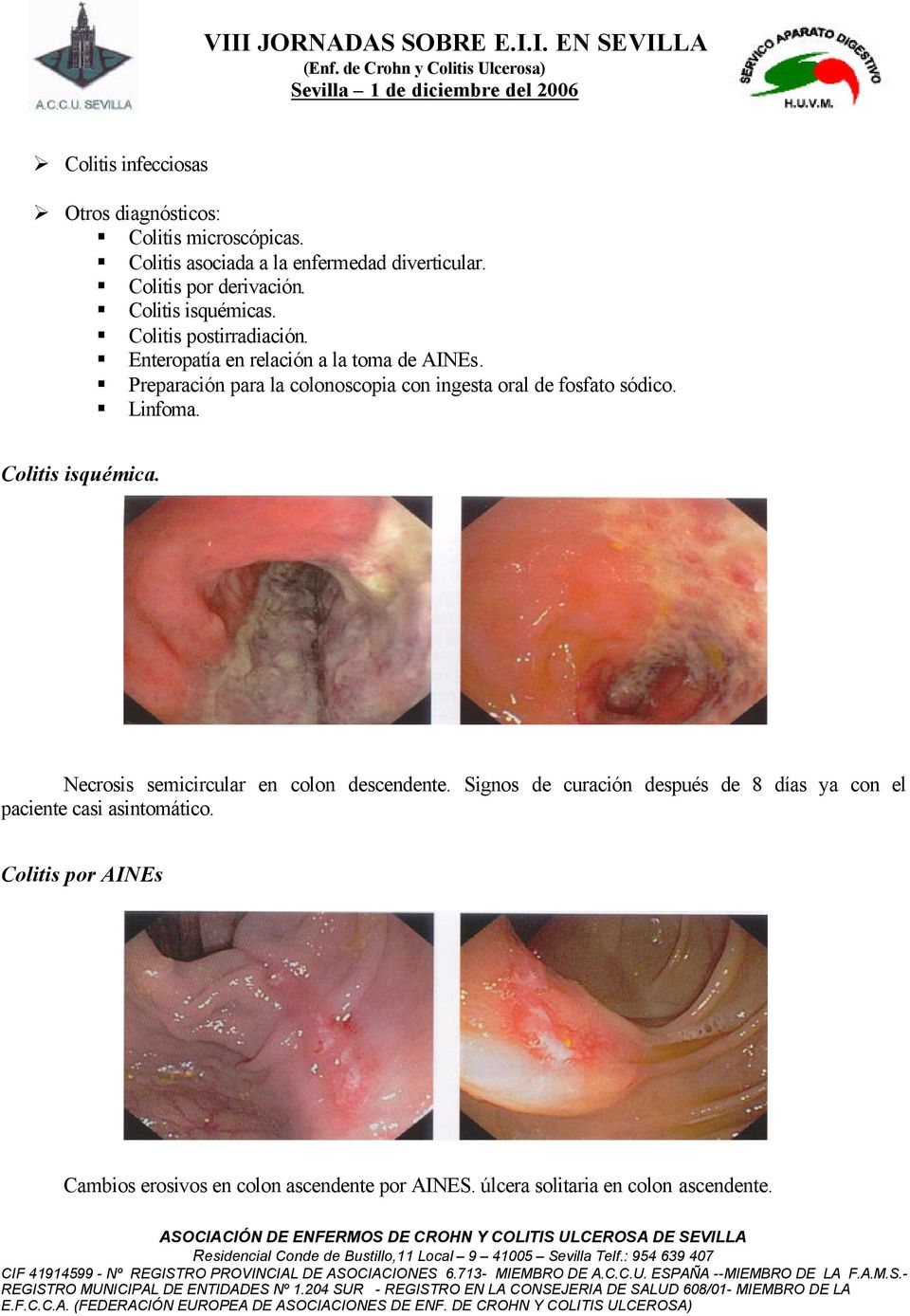 Preparación para la colonoscopia con ingesta oral de fosfato sódico. Linfoma. Colitis isquémica.