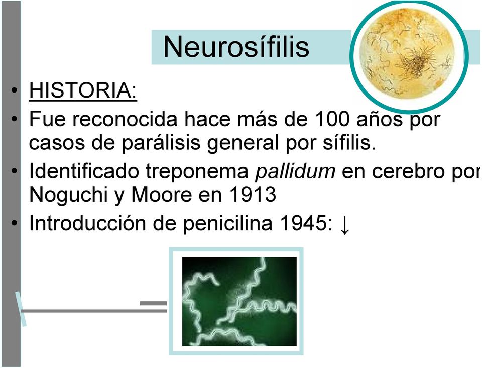 Identificado treponema pallidum en cerebro por