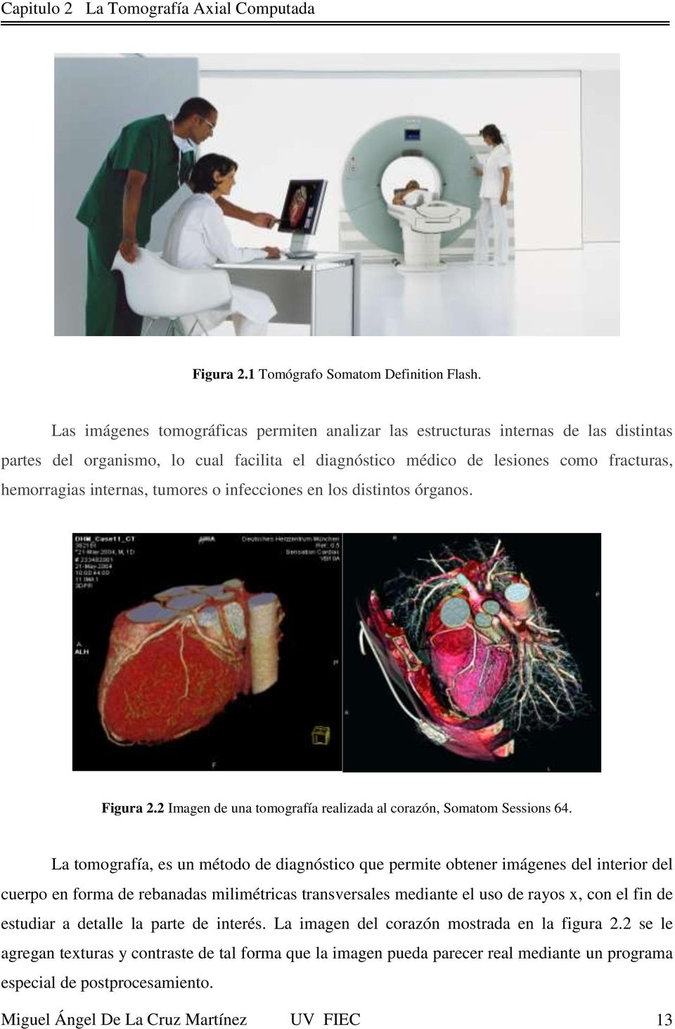 tumores o infecciones en los distintos órganos. Figura 2.2 Imagen de una tomografía realizada al corazón, Somatom Sessions 64.