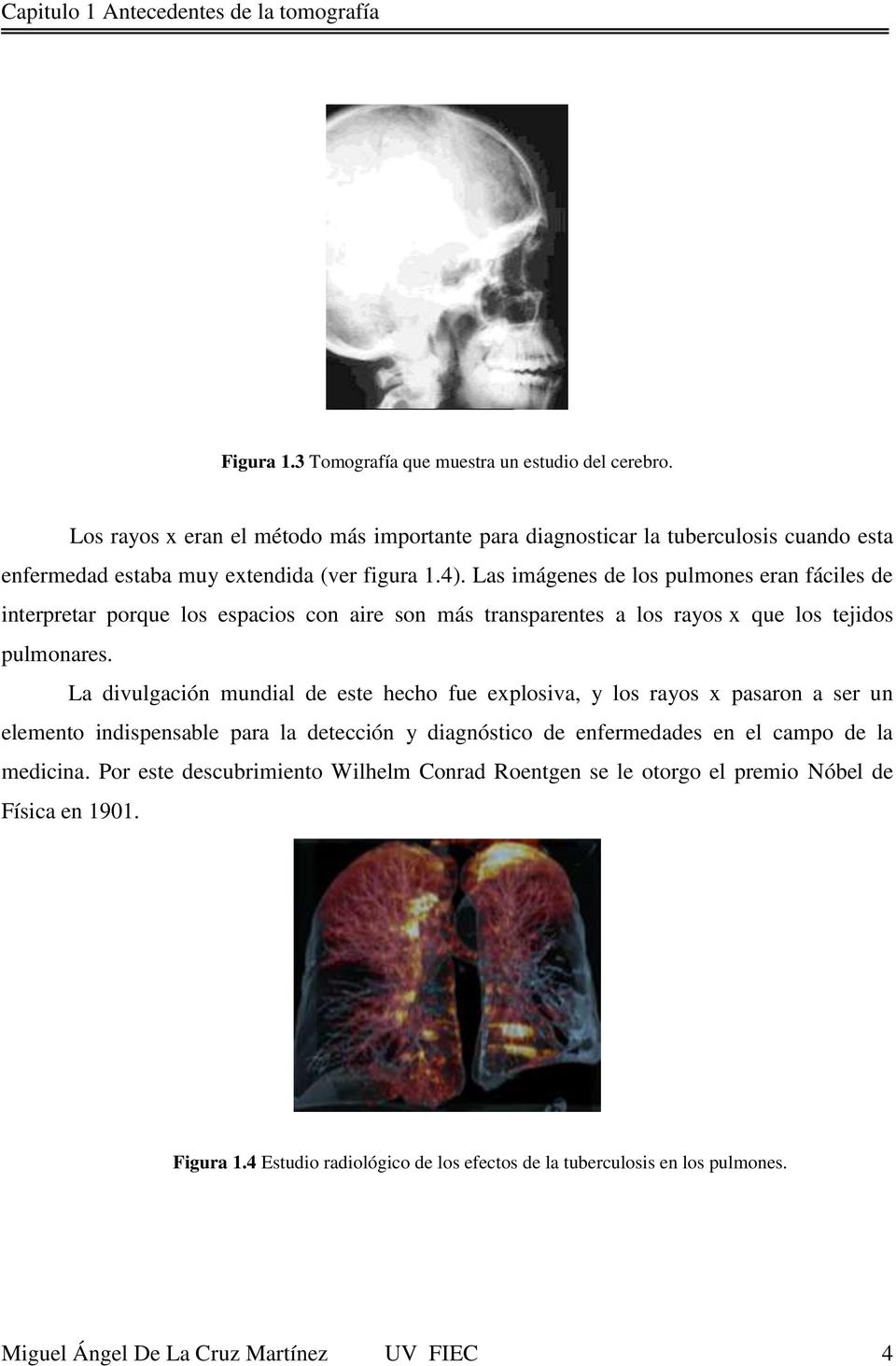 Las imágenes de los pulmones eran fáciles de interpretar porque los espacios con aire son más transparentes a los rayos x que los tejidos pulmonares.