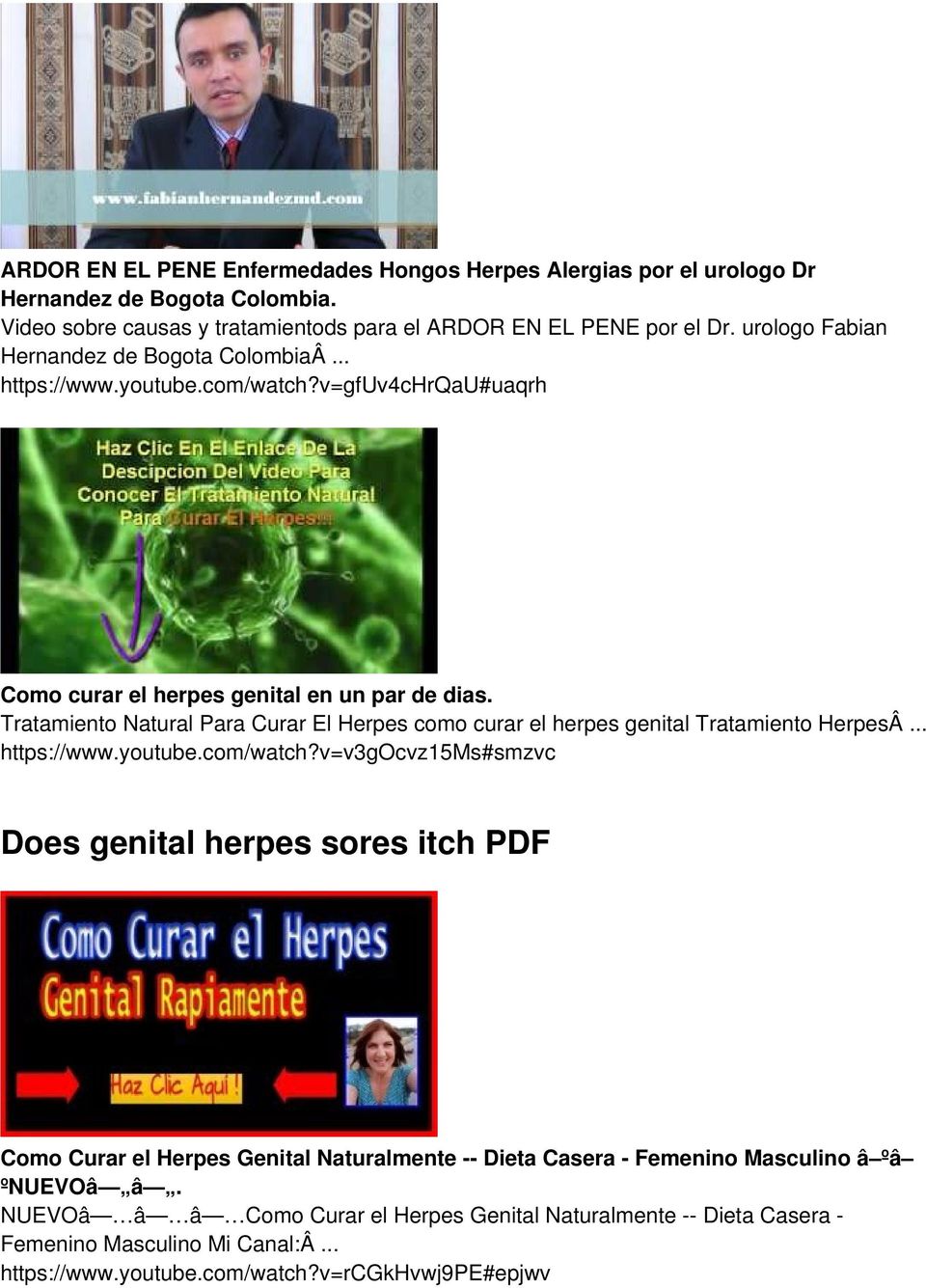 Tratamiento Natural Para Curar El Herpes como curar el herpes genital Tratamiento HerpesÂ... https://www.youtube.com/watch?