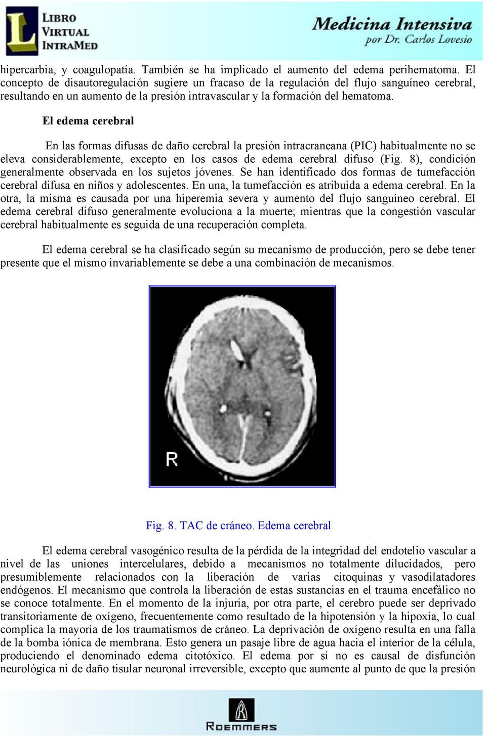 El edema cerebral En las formas difusas de daño cerebral la presión intracraneana (PIC) habitualmente no se eleva considerablemente, excepto en los casos de edema cerebral difuso (Fig.