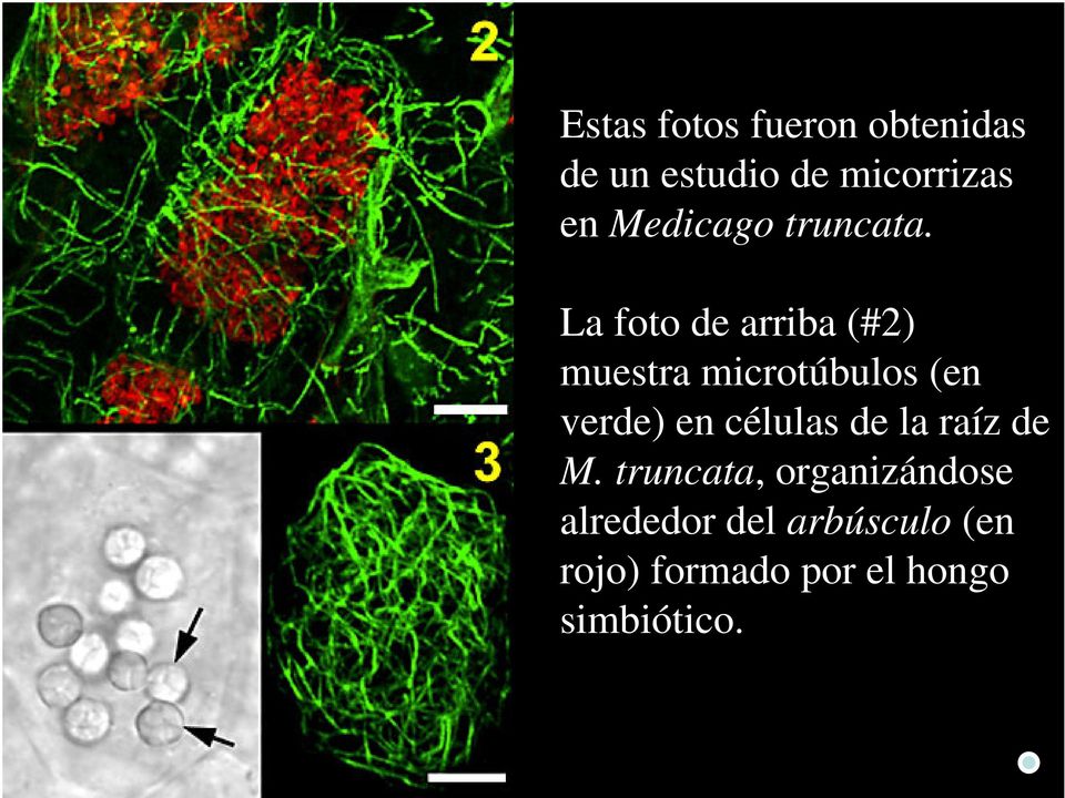 La foto de arriba (#2) muestra microtúbulos (en verde) en