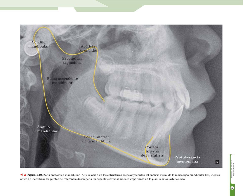 Zona anatómica mandibular (A) y relación en las estructuras óseas adyacentes.