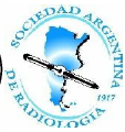 Programa Nacional de Consensos Inter-Sociedades Programa Argentino de Consensos de Enfermedades Oncológicas CONSENSO NACIONAL INTER-SOCIEDADES SOBRE CÁNCER DE ENDOMETRIO Junio de 2016 Instituciones