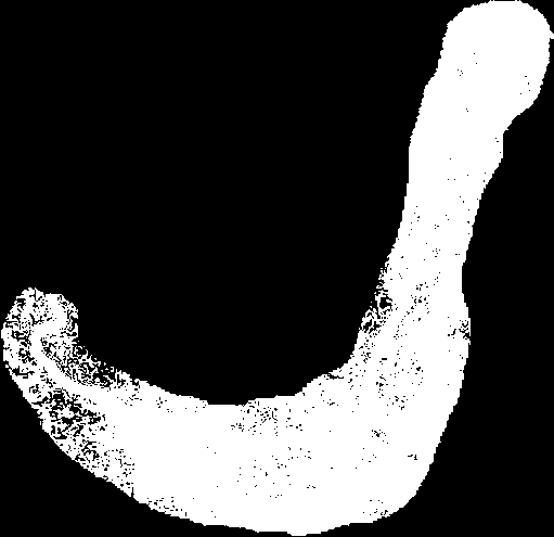 EJEMPLOS CARACTERÍSTICOS Sipunculus Puede medir 35-40 cm Vive en sedimentos blandos Son formas microfágicas suspensívoras, come lo que le cae Cada tentáculos lleva en