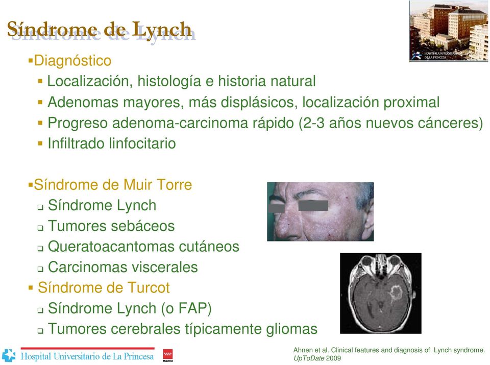 Muir Torre Síndrome Lynch Tumores sebáceos Queratoacantomas cutáneos Carcinomas viscerales Síndrome de Turcot Síndrome