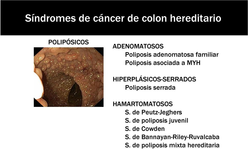 HIPERPLÁSICOS-SERRADOS Poliposis serrada HAMARTOMATOSOS S.