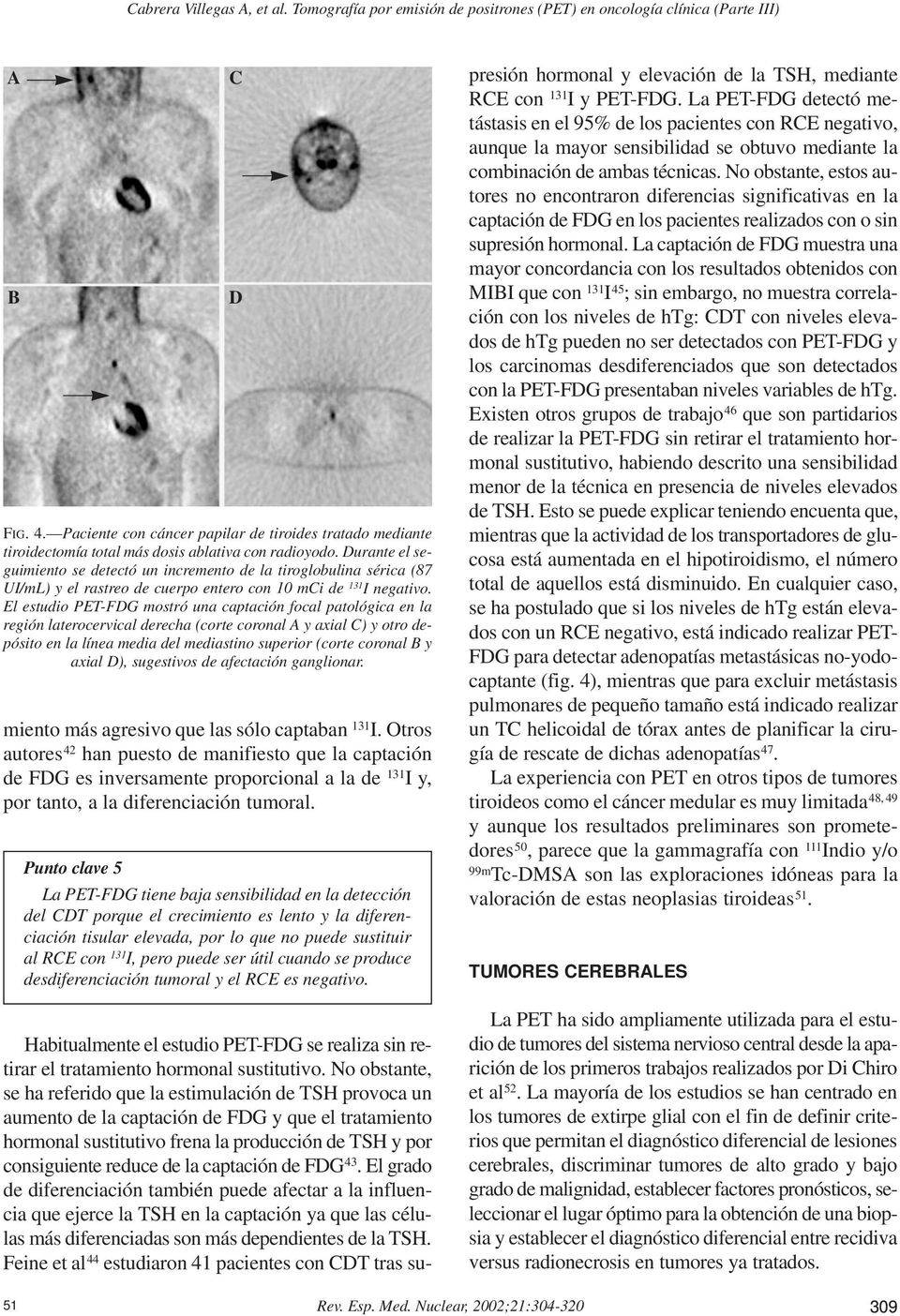 El estudio PET-FDG mostró una captación focal patológica en la región laterocervical derecha (corte coronal A y axial C) y otro depósito en la línea media del mediastino superior (corte coronal B y