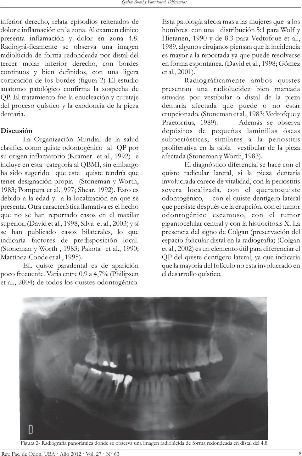 (figura 2) El estudio anatomo patológico confirma la sospecha de QP. El tratamiento fue la enucleación y curetaje del proceso quístico y la exodoncia de la pieza dentaria.
