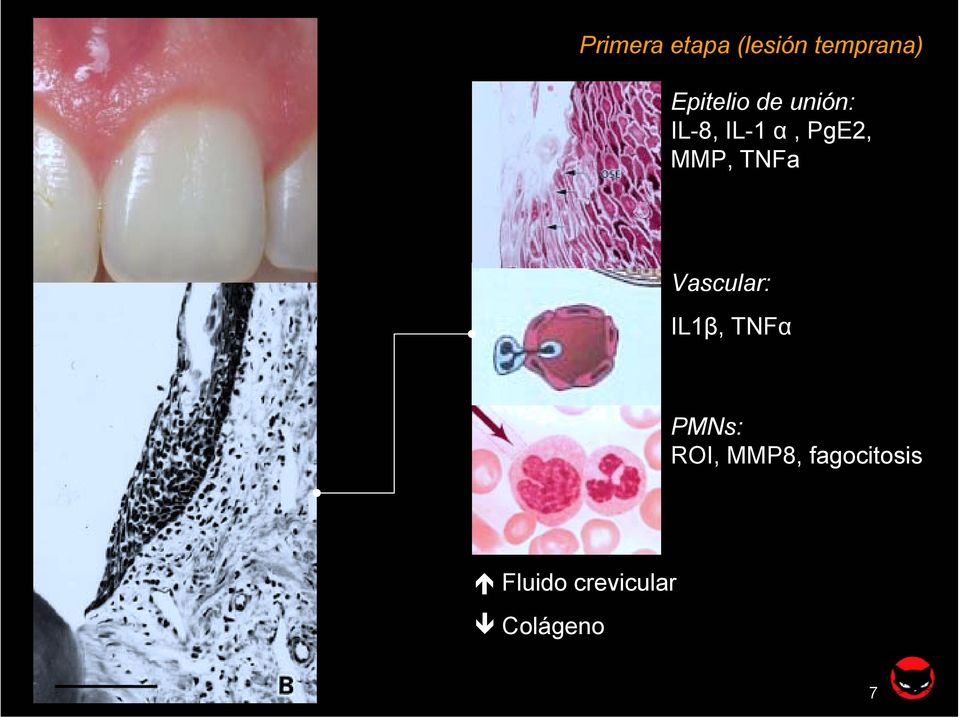 Vascular: IL1β, TNFα PMNs: ROI, MMP8,
