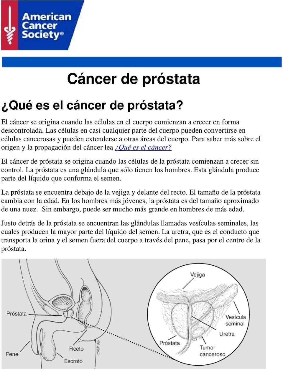 Para saber más sobre el origen y la propagación del cáncer lea Qué es el cáncer? El cáncer de próstata se origina cuando las células de la próstata comienzan a crecer sin control.