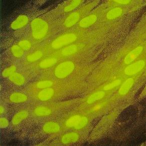 CITOMEGALOVIRUS: AISLAMIENTO Cultivo de fibroblastos de prepucio