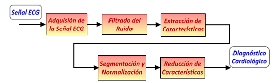 4. MARCO TEÓRICO: MODELOS DE FILTRADO Un esquema comúnmente aceptado en el análisis de la señal electrocardiográfica consiste en el que se muestra en la ilustración siguiente.
