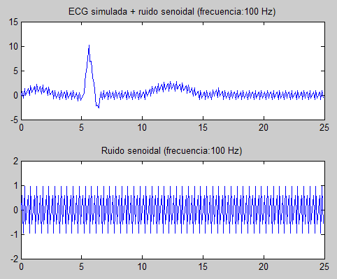 Ilustración 29: señal ECG simulada con ruido senoidal procedente de una fuente senoidal a 50 Hz