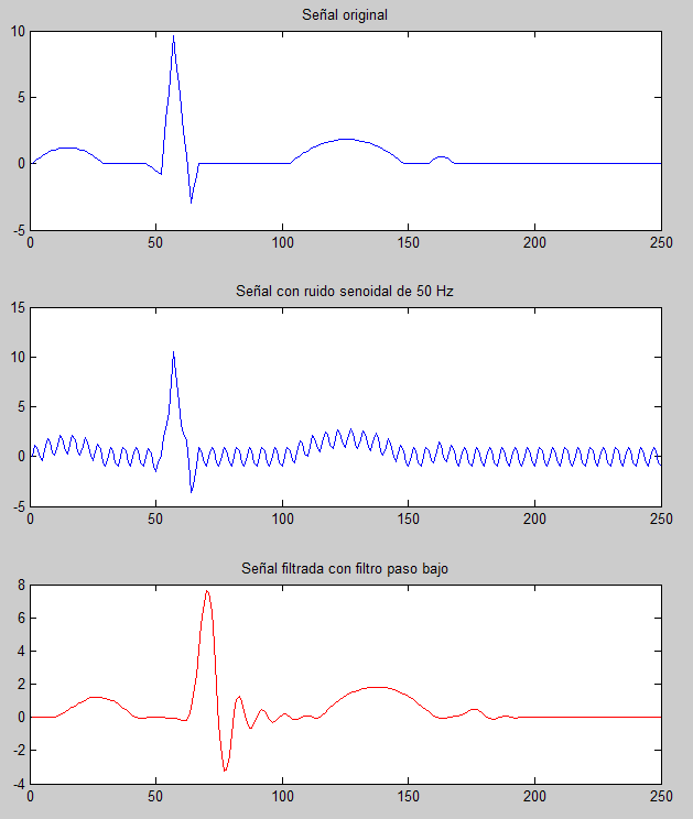 Ilustración 35: representación gráfica de la señal original, la señal con ruido, y la señal una vez se ha filtrado mediante el filtro paso bajo de Butterworth. 5.4.