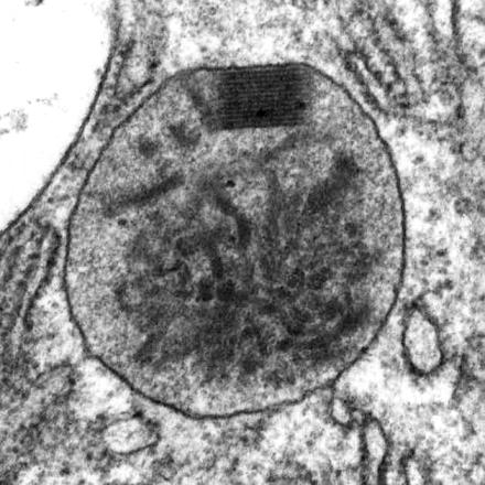 Peroxisomas Vesículas importantes que se encuentran en el citoplasma de las células eucarióticas.