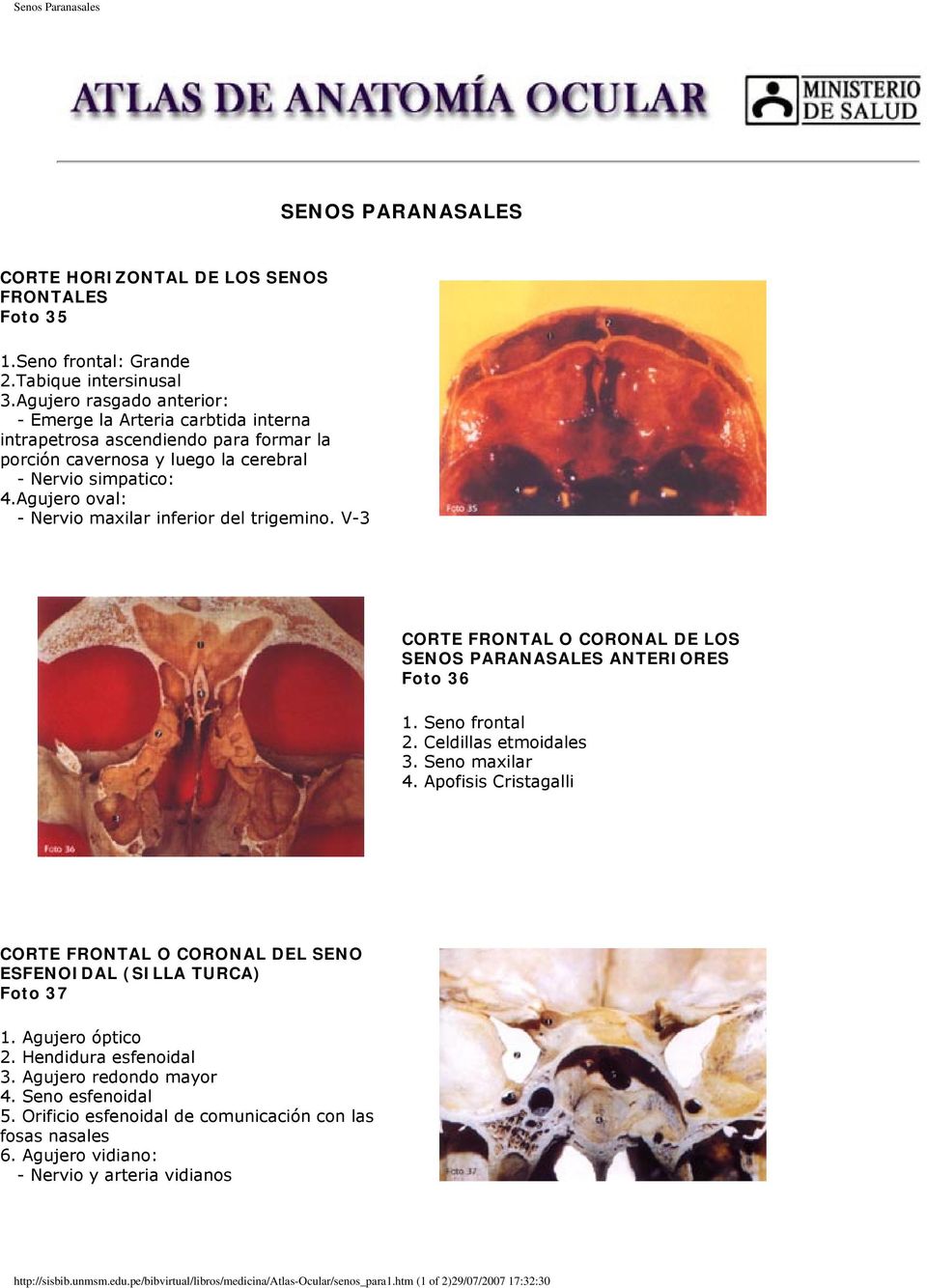 Agujero oval: - Nervio maxilar inferior del trigemino. V-3 CORTE FRONTAL O CORONAL DE LOS SENOS PARANASALES ANTERIORES Foto 36 1. Seno frontal 2. Celdillas etmoidales 3. Seno maxilar 4.