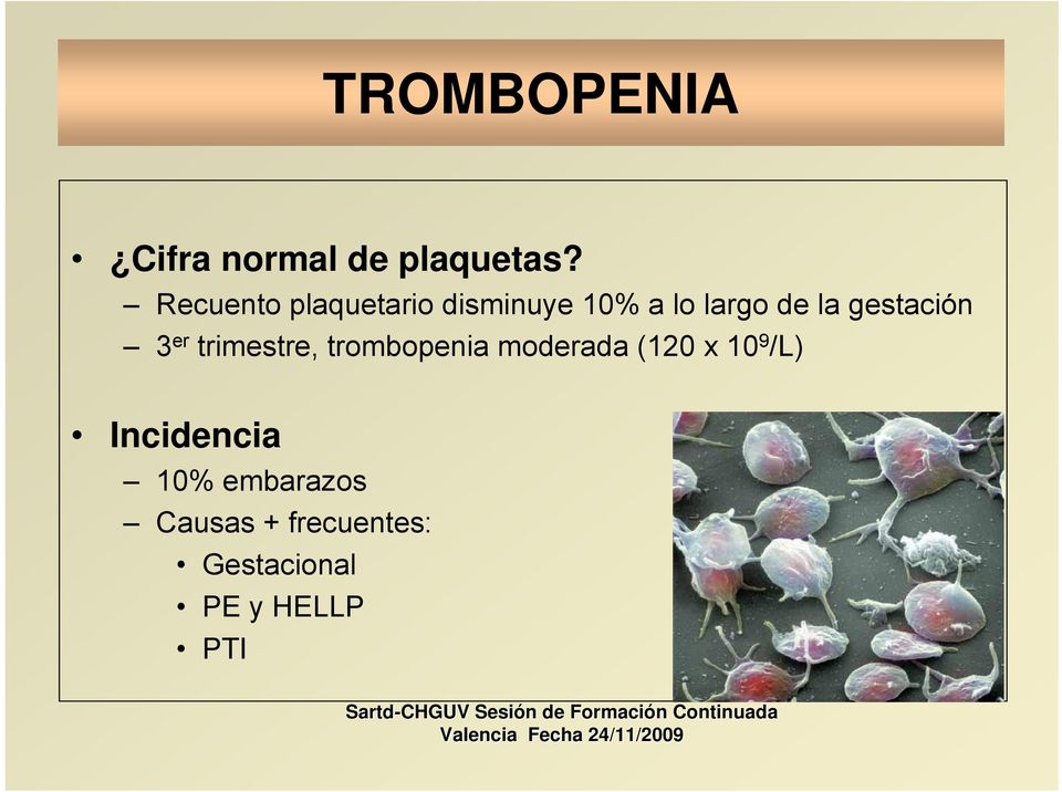 gestación 3 er trimestre, trombopenia moderada (120 x 10