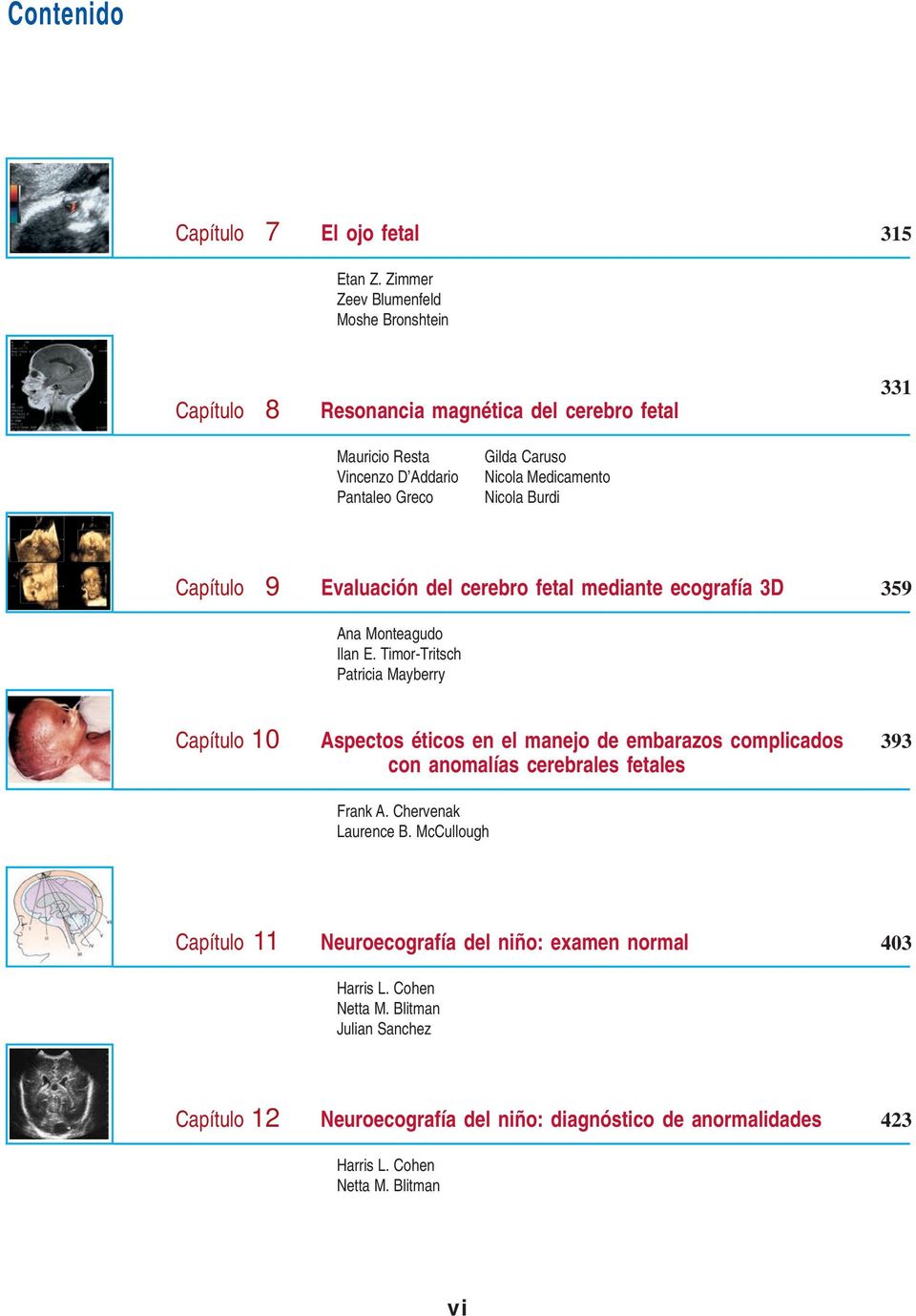 Nicola Burdi Capítulo 9 Evaluación del cerebro fetal mediante ecografía 3D 359 Ana Monteagudo Ilan E.