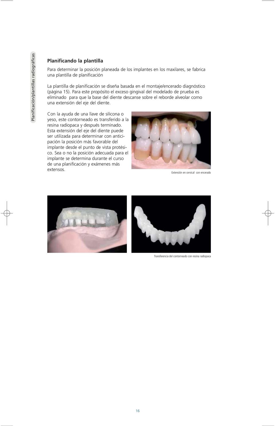 Para este propósito el exceso gingival del modelado de prueba es eliminado para que la base del diente descanse sobre el reborde alveolar como una extensión del eje del diente.