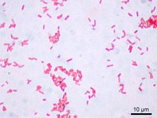 Escherichia coli Características morfológicas y metabólicas típicas de las Enterobacterias.