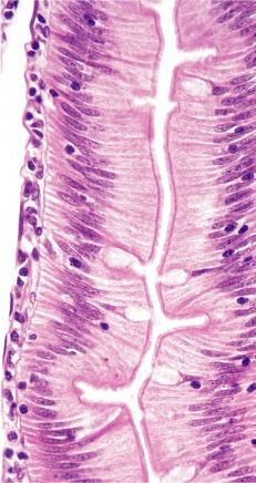 Tunica Mucosa Epitelio de Revestimiento Simple cilíndrico Constituido por