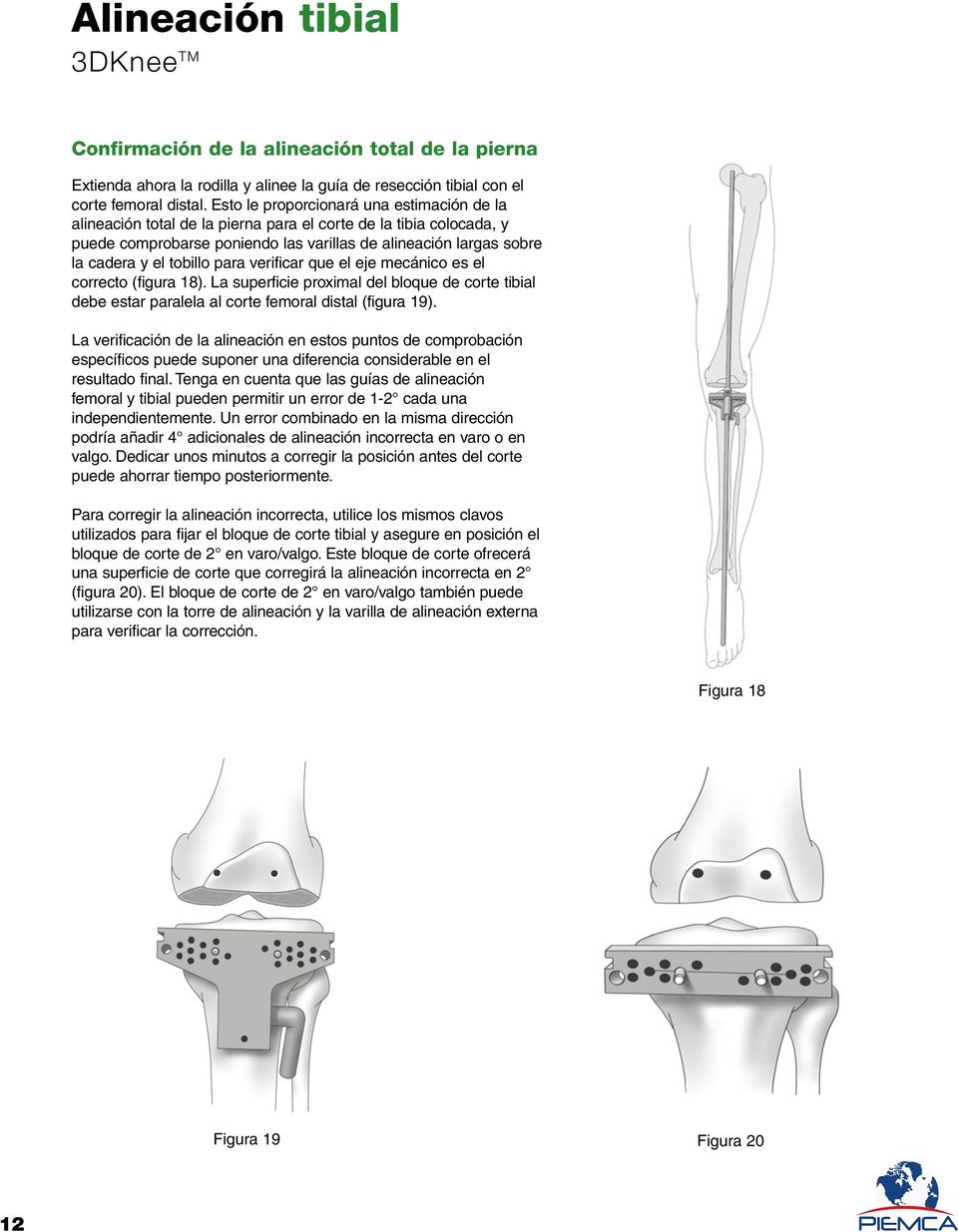 tobillo para verificar que el eje mecánico es el correcto (figura 18). La superficie proximal del bloque de corte tibial debe estar paralela al corte femoral distal (figura 19).