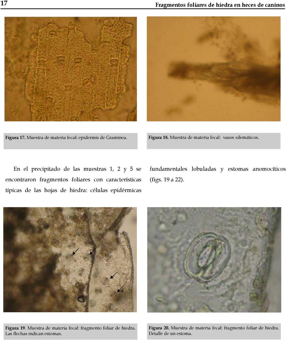 En el precipitado de las muestras 1, 2 y 5 se encontraron fragmentos foliares con características típicas de las hojas de hiedra: células