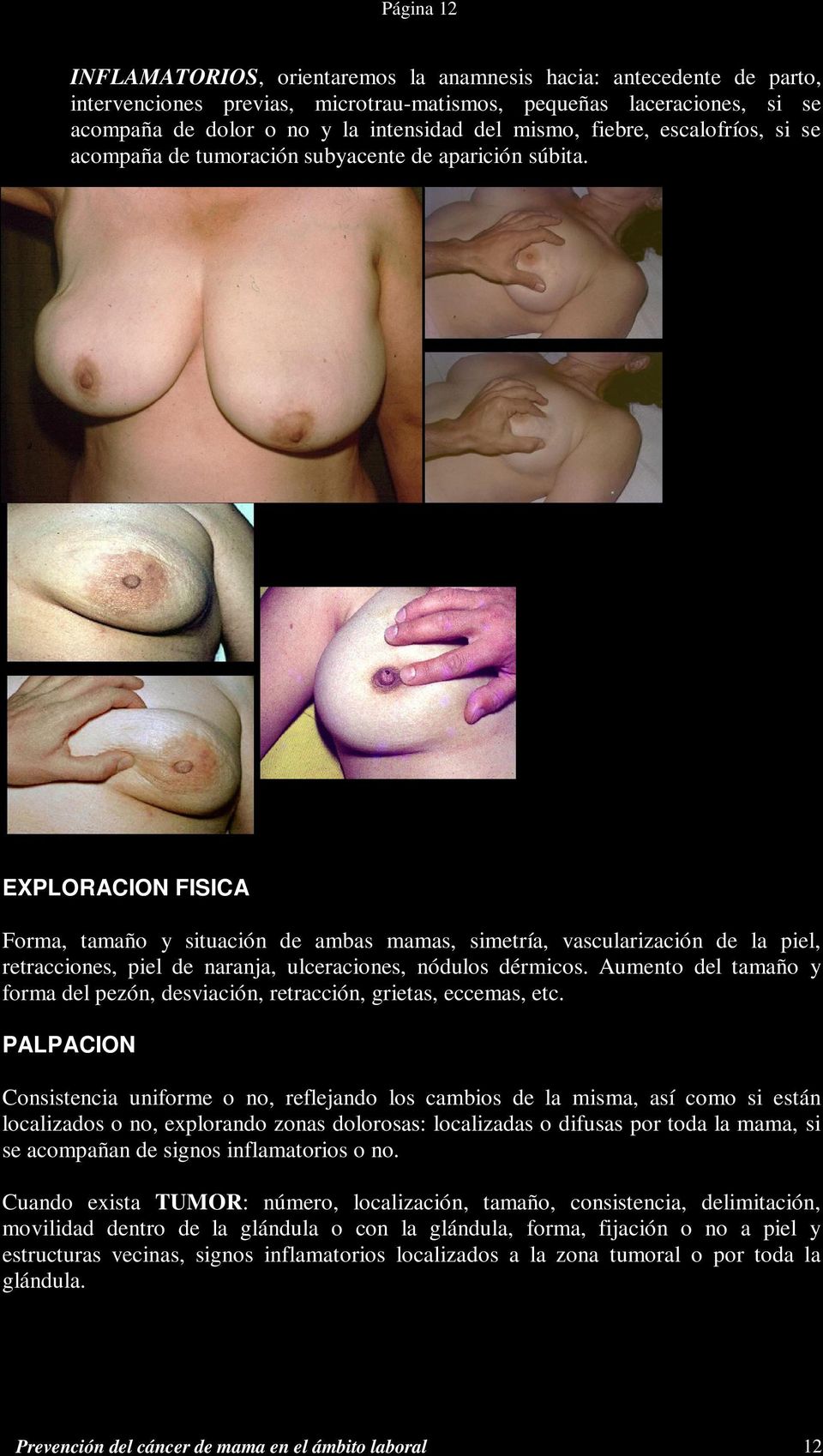 EXPLORACION FISICA Forma, tamaño y situación de ambas mamas, simetría, vascularización de la piel, retracciones, piel de naranja, ulceraciones, nódulos dérmicos.