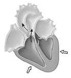 Diástole ventricular Los ventrículos comienzan a relajarse luego de una contracción. Las aurículas se llenan de sangre. Todas las válvulas están cerradas.