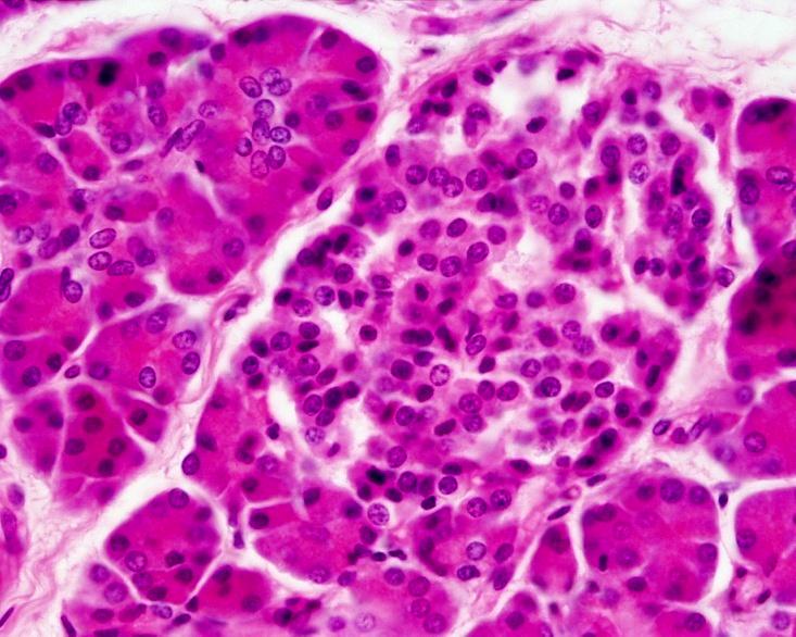 Glándulas tubuloalveolar compuesta Células acinosas Páncreas Exocrino Acinos redondos u ovales Capa epitelial