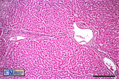 HÍGADO Histología Estroma Cápsula de Glisson de tejido conectivo Tejido conectivo (lobulillos) Parénquima