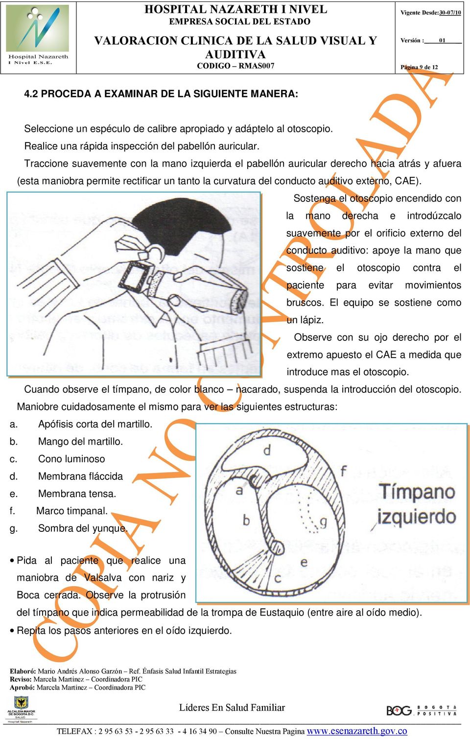 Sostenga el otoscopio encendido con la mano derecha e introdúzcalo suavemente por el orificio externo del conducto auditivo: apoye la mano que sostiene el otoscopio contra el paciente para evitar
