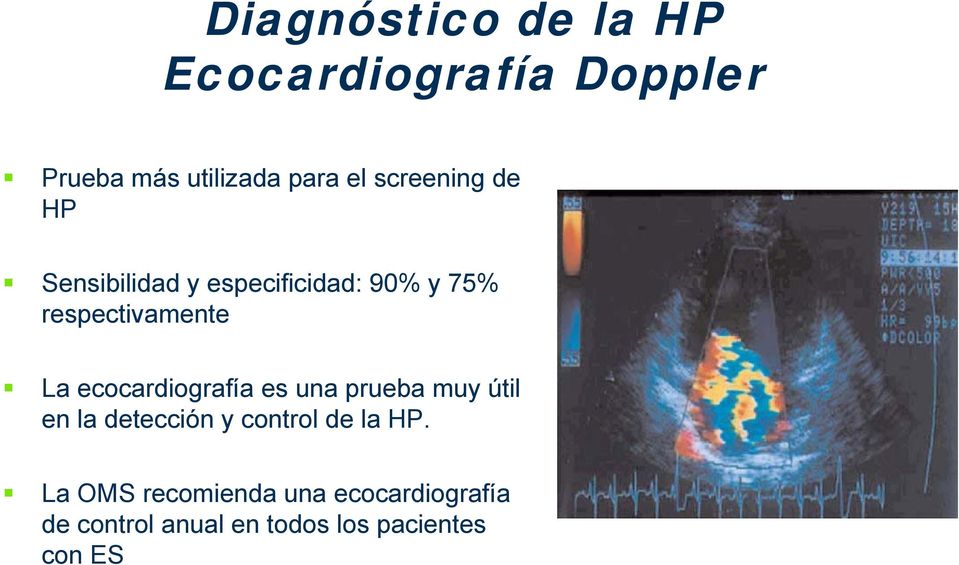 ecocardiografía es una prueba muy útil en la detección y control de la HP.