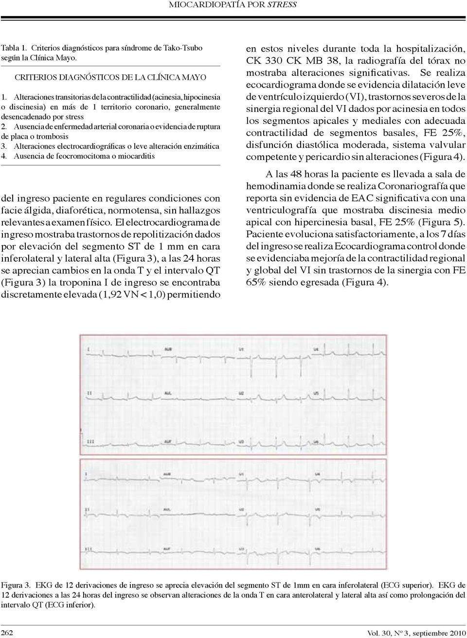 Ausencia de enfermedad arterial coronaria o evidencia de ruptura de placa o trombosis 3. Alteraciones electrocardiográficas o leve alteración enzimática 4.